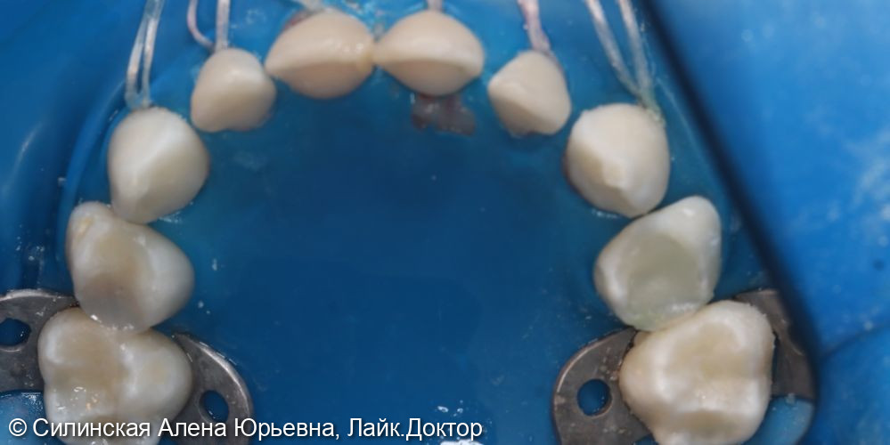 Лечение во сне фото 5 · Вологда