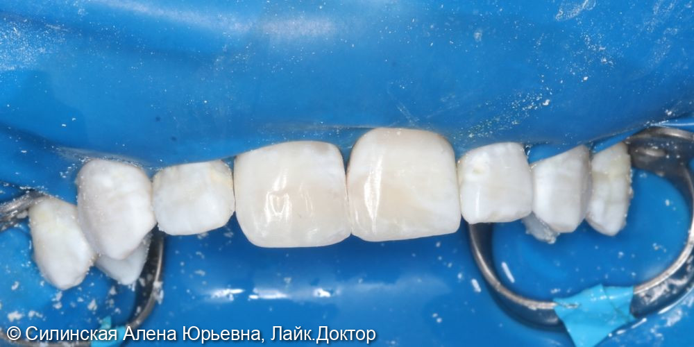 Травма 11 и 21 фото 3 · Вологда
