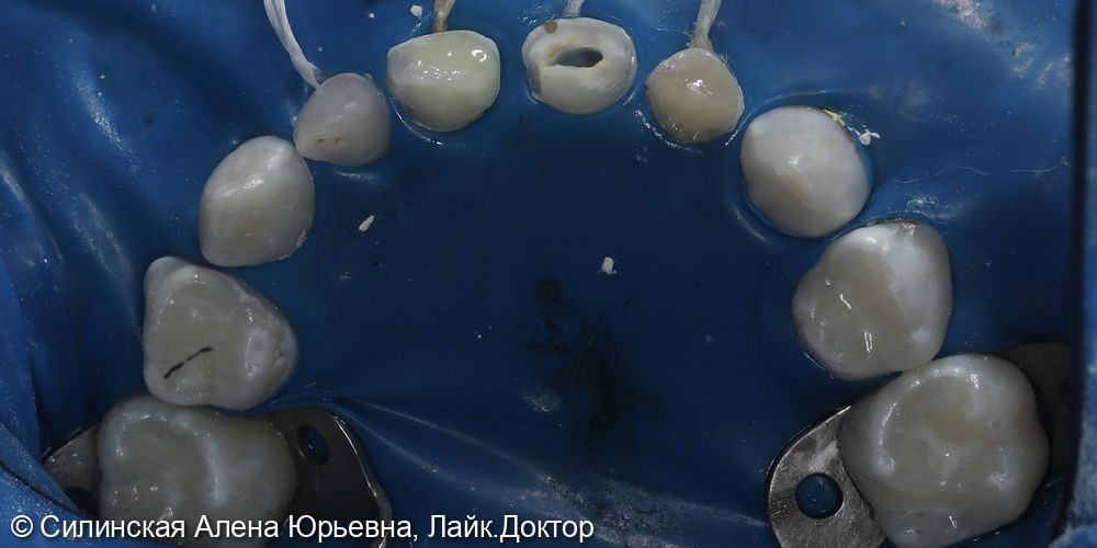 Лечение в наркозе фото 5 · Вологда