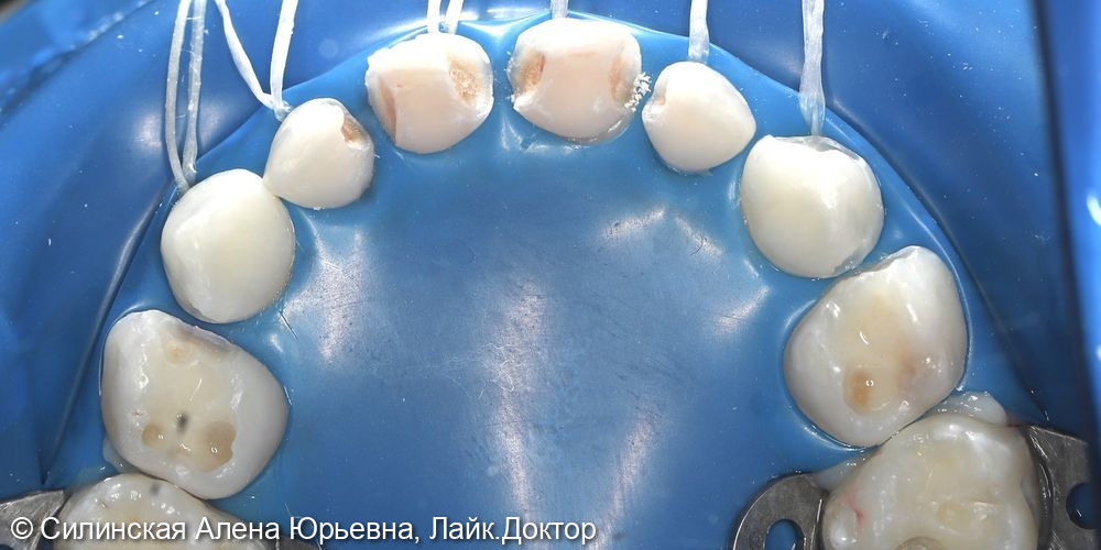 Лечение в наркозе фото 6 · Вологда