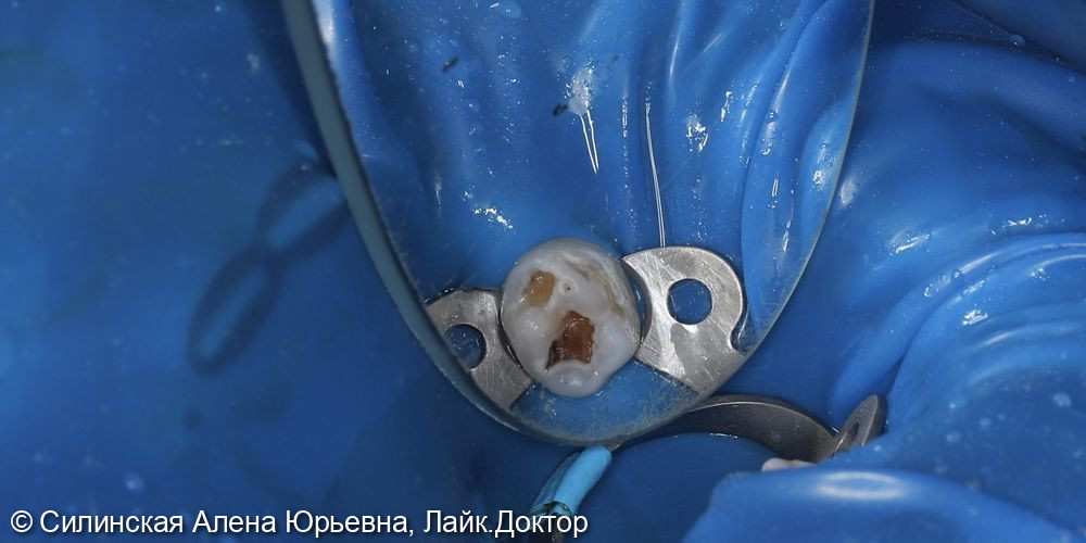 Лечение в наркозе фото 4 · Вологда