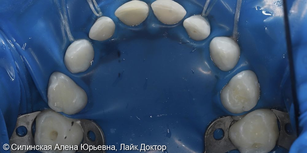 Лечение в наркозе фото 8 · Вологда