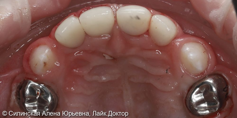 Лечение в наркозе - фото №10