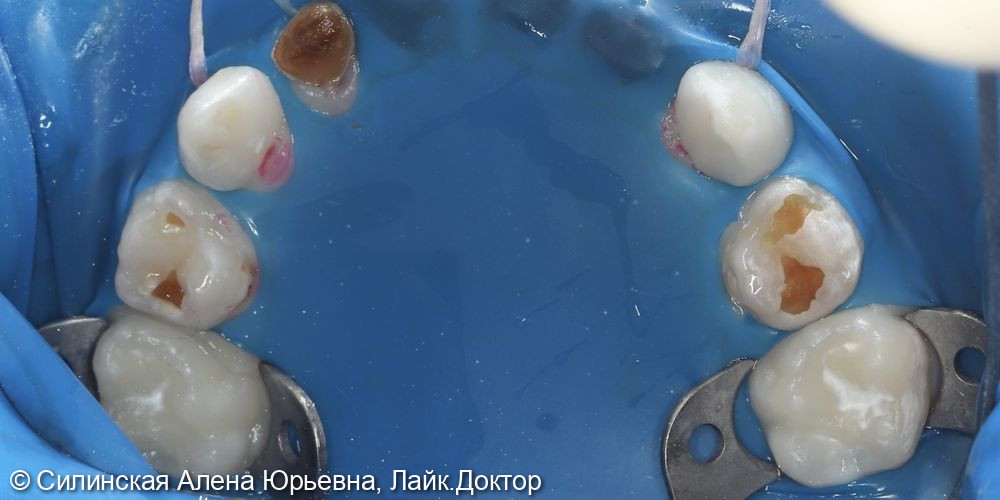 Лечение в наркозе фото 7 · Вологда