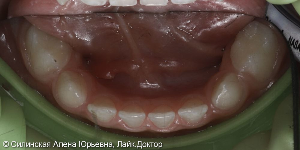Лечение в наркозе фото 3 · Вологда