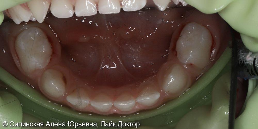 Лечение в наркозе фото 10 · Вологда