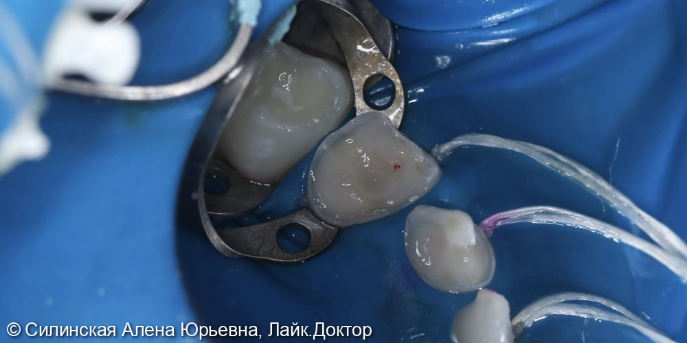 Лечение в наркозе фото 9 · Вологда