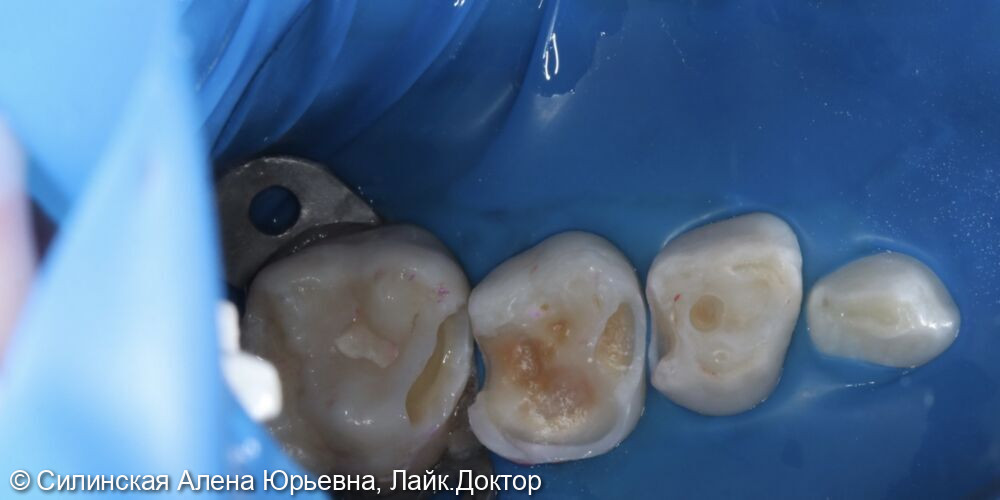Лечение в наркозе фото 10 · Вологда