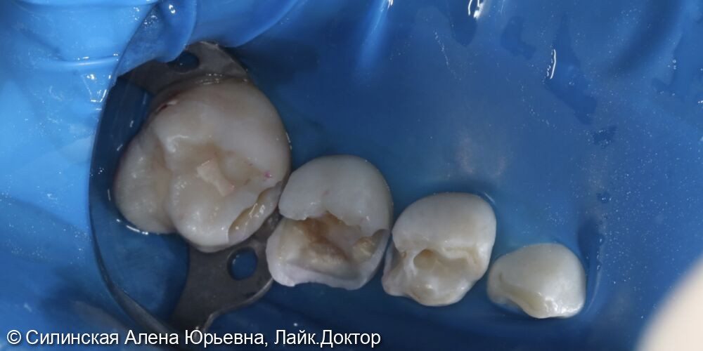 Лечение в наркозе фото 11 · Вологда