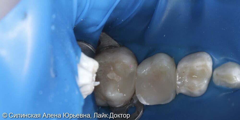 Лечение в наркозе фото 12 · Вологда