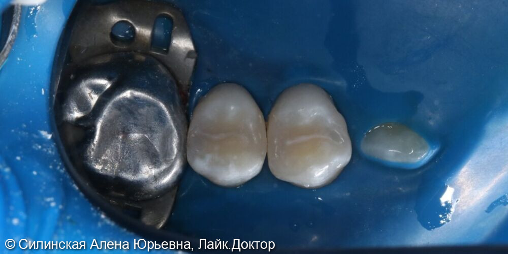 После