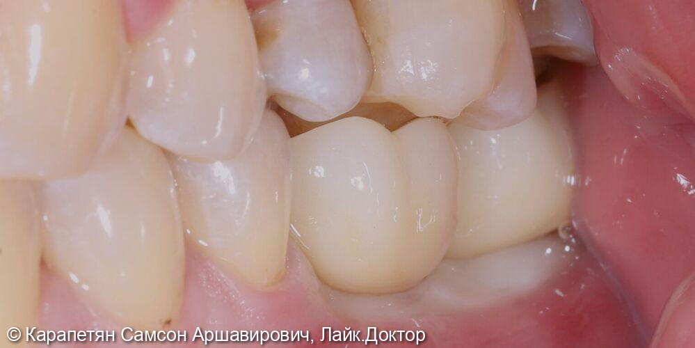 После