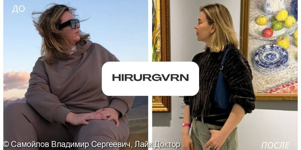 Бариатрическая операция - фото №1