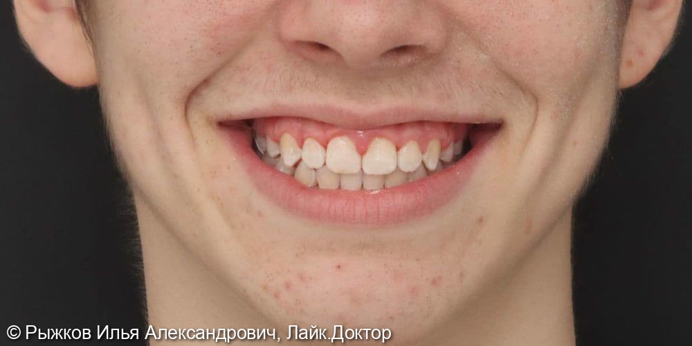 Лечение брекет-система фото 6 · Вологда