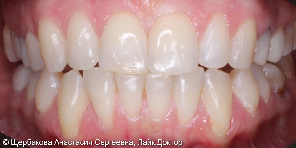 Рецессии 34-44 фото 2 · Вологда