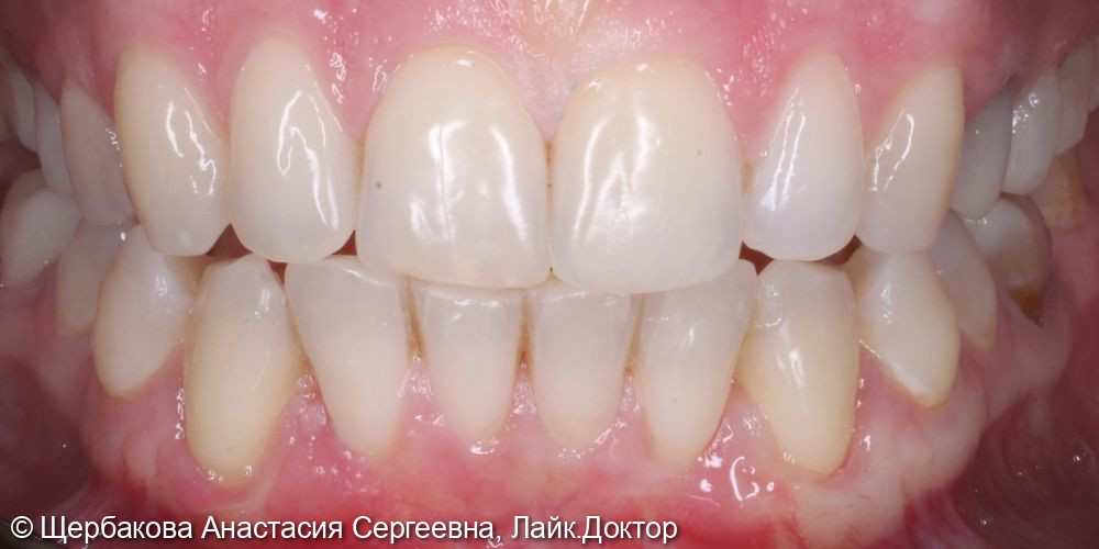 Рецессии 34-44 фото 4 · Вологда