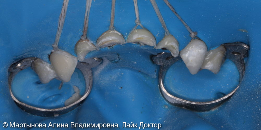 Лечение во сне 2 года фото 2 · Вологда