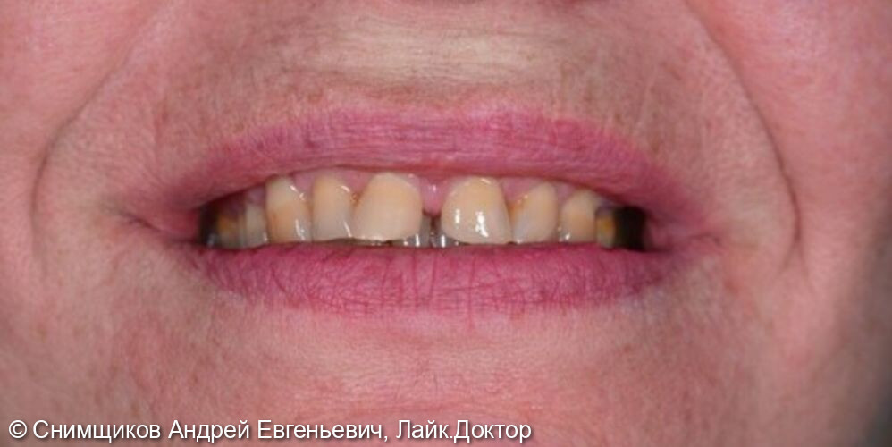 Лечение и протезирование зубов - фото №1