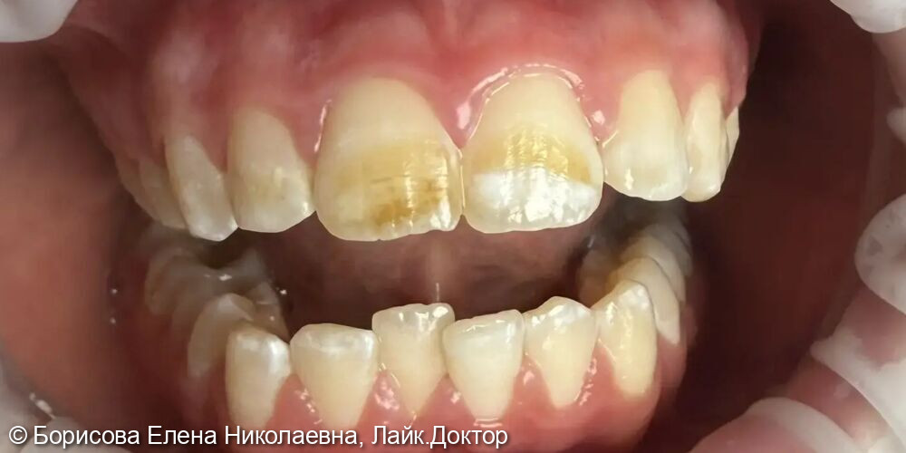 До