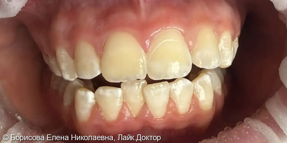 После