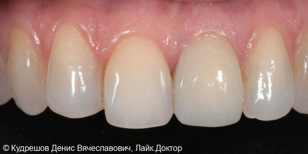 После