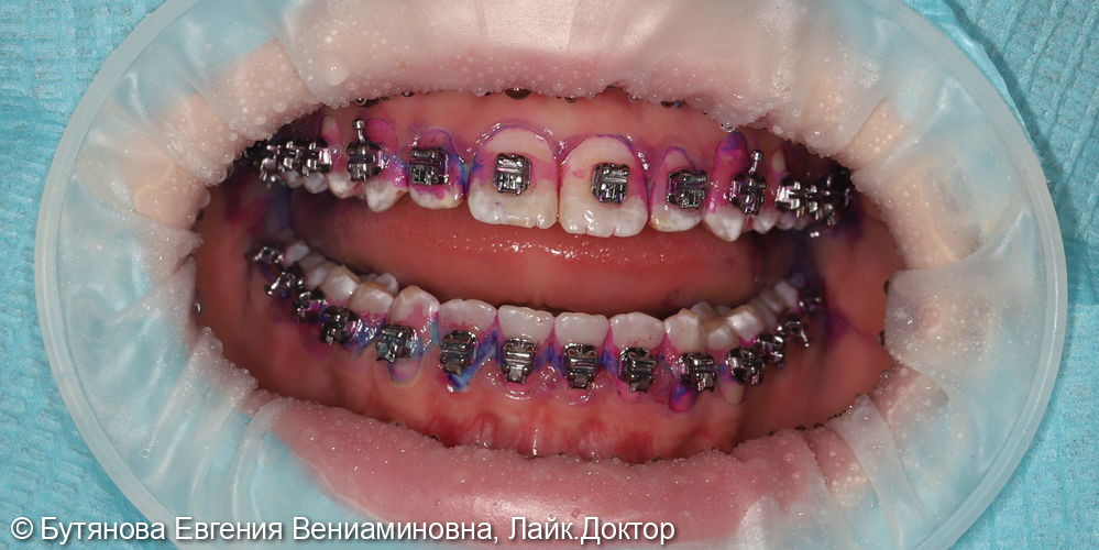 Профессиональная гигиена фото 2 · Вологда