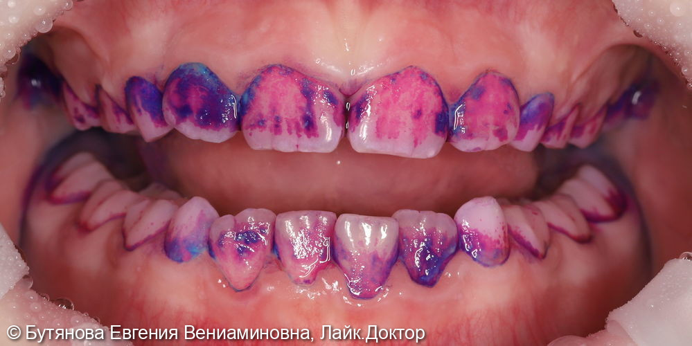 Профгигиена для детей фото 2 · Вологда