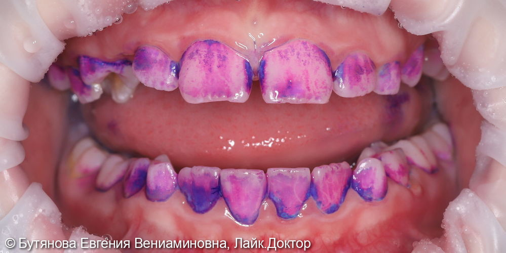 Профгигиена для детей фото 2 · Вологда