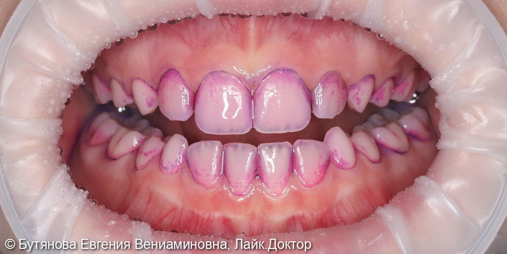 Профгигиена для подростка фото 2 · Вологда