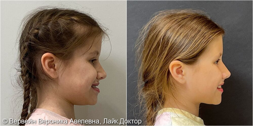 До